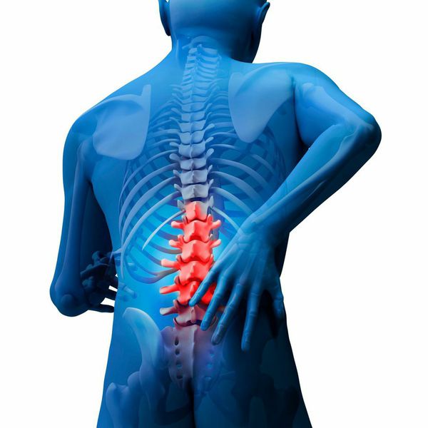 Spinal Stenosis and Low Back Pain - Atlanta Brain and Spine Care