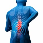 Best Lumbar Cervical Spinal Stenosis Treatment Beverly Hills